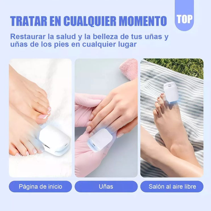 Dispositivo Láser para Tratamiento de Hongos en las Uñas
