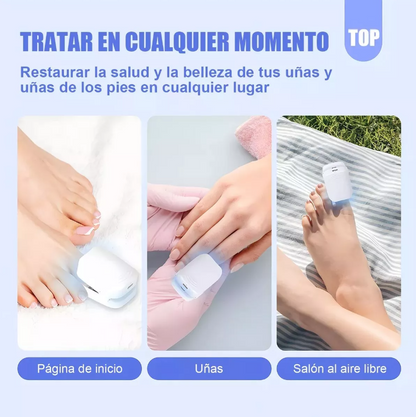 Dispositivo Láser para Tratamiento de Hongos en las Uñas